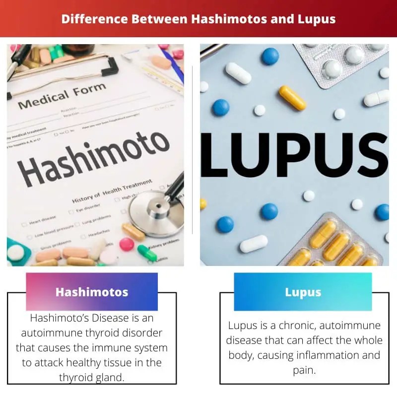 Sự khác biệt giữa Hashimotos và Lupus