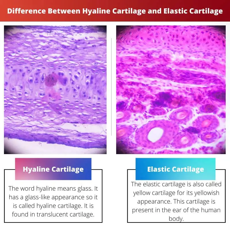 Difference Between Hyaline Cartilage and Elastic Cartilage