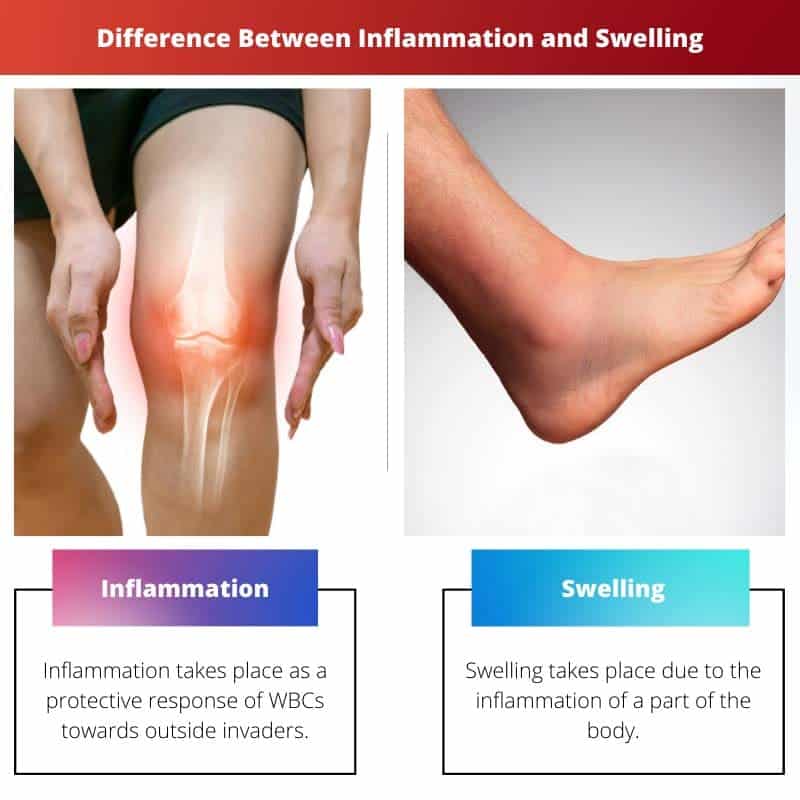 Inflammation Vs Swelling Difference And Comparison