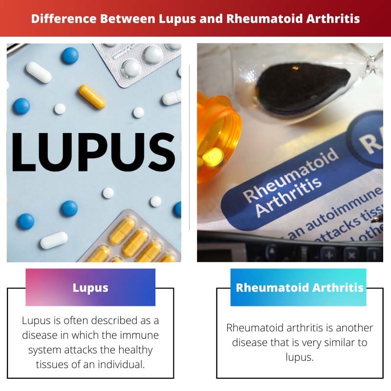 Rozdíl mezi lupusem a revmatoidní artritidou