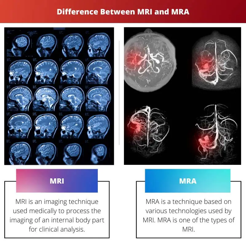 Difference Between MRI and MRA