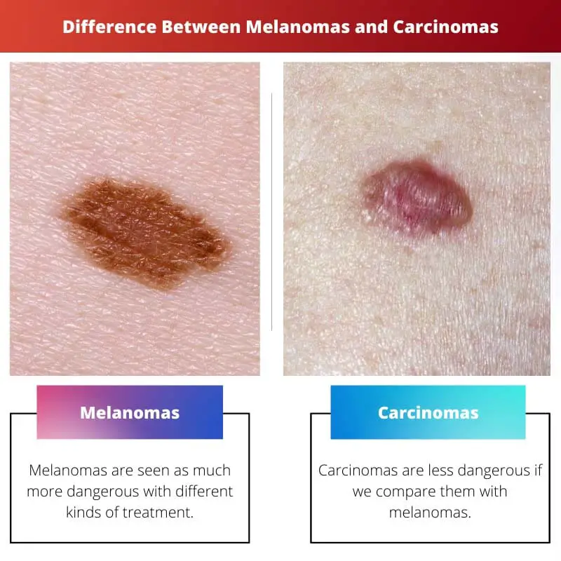 Différence entre les mélanomes et les carcinomes