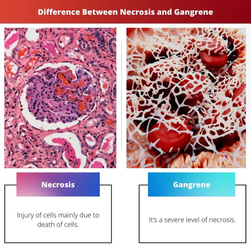 Atšķirība starp nekrozi un gangrēnu