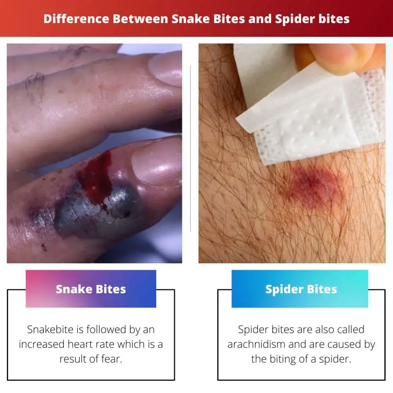 Diferencia entre mordeduras de serpiente y mordeduras de araña