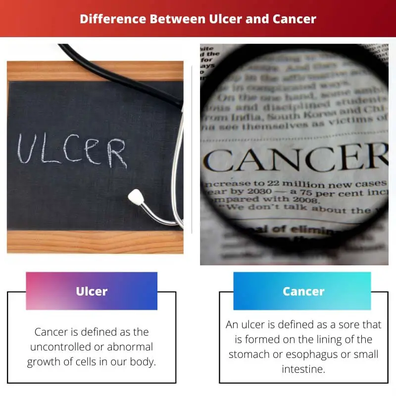Atšķirība starp čūlu un vēzi
