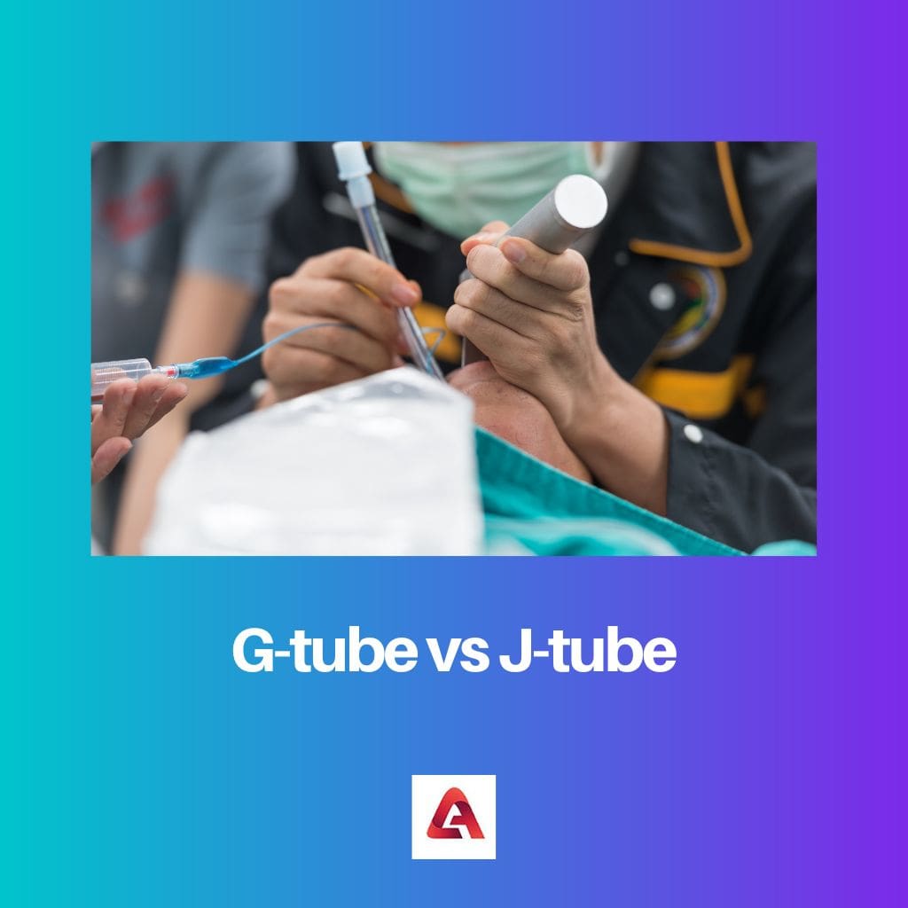 Tubo G vs tubo J
