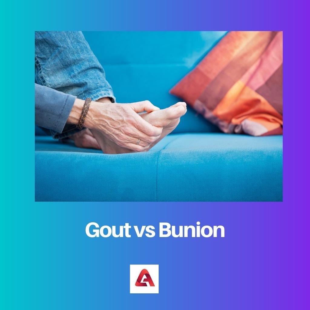 Bệnh gút vs Bunion