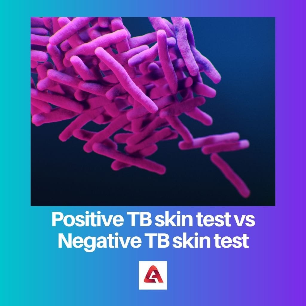 Test cutané TB positif vs test cutané TB négatif 1