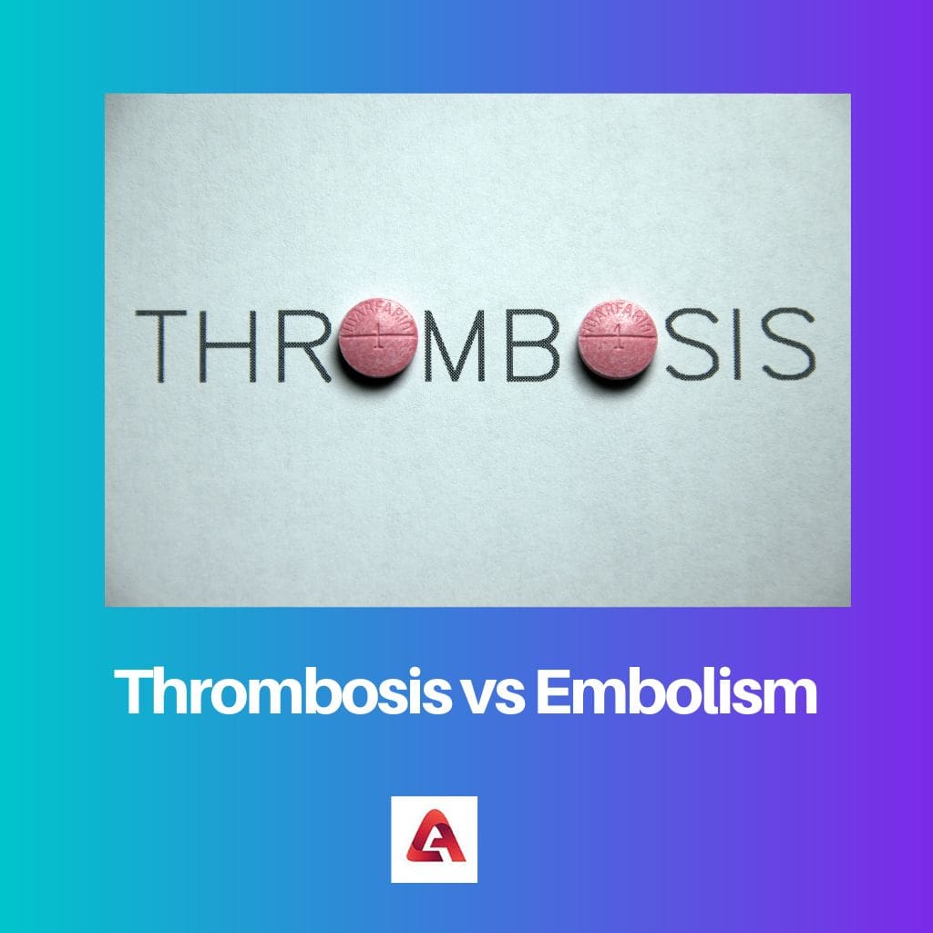 Thrombose vs embolie