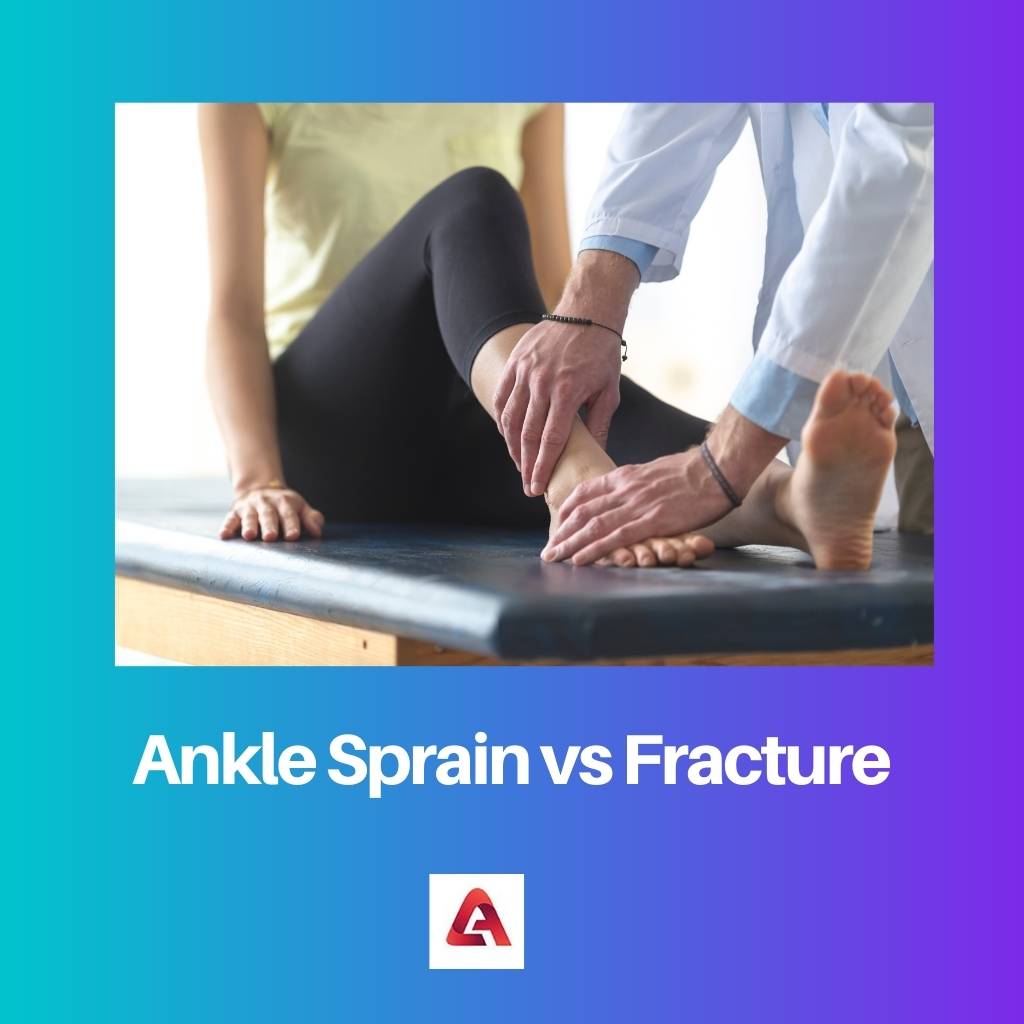 Ankle Sprain vs Fracture