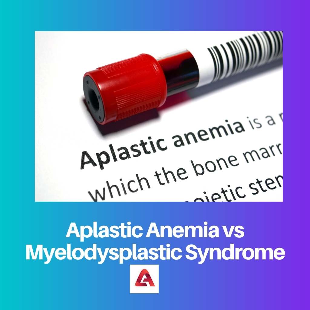 Aplastic Anemia vs Myelodysplastic Syndrome