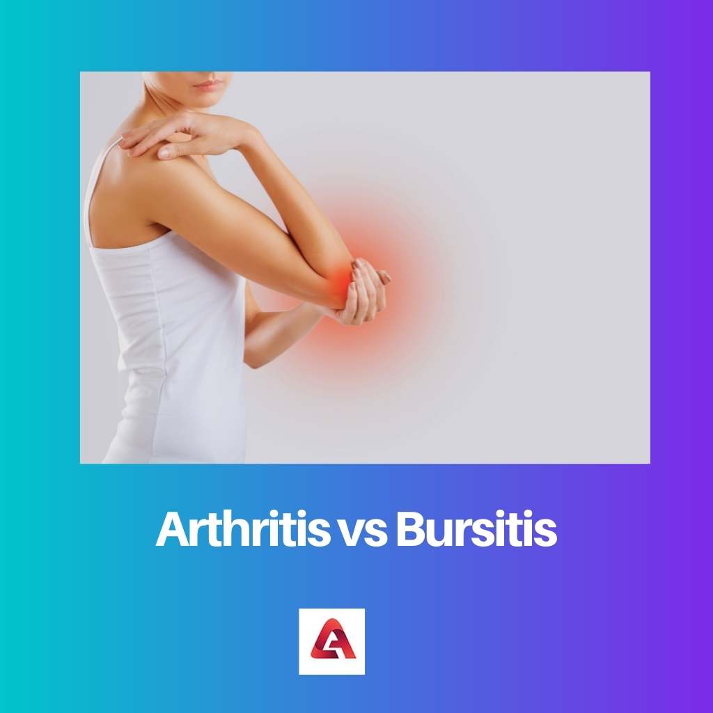 Arthrite vs Bursite