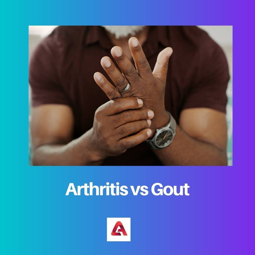 Arthritis vs Gout