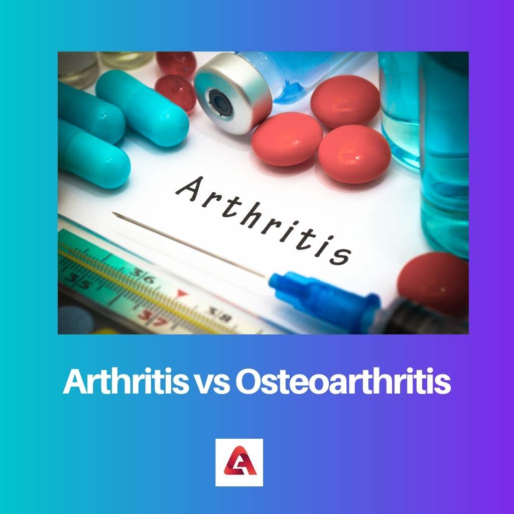 Arthrite vs arthrose