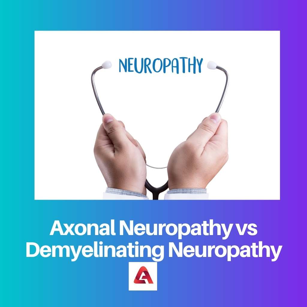 Neuropatia assonale vs neuropatia demielinizzante