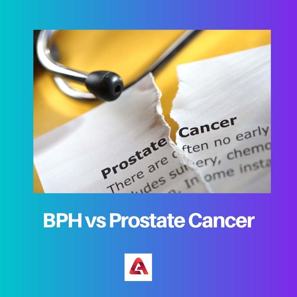BPH مقابل سرطان البروستاتا