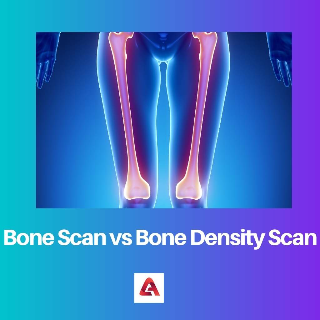 Scansione ossea vs scansione della densità ossea