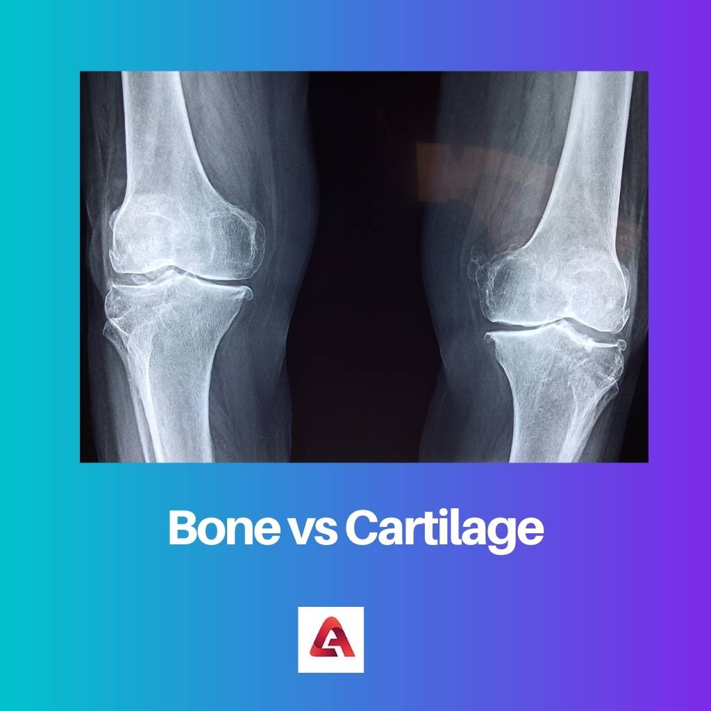 Bone vs Cartilage