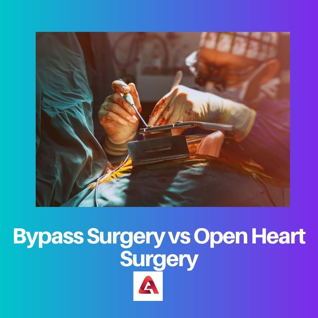 Cirugía de derivación versus cirugía a corazón abierto