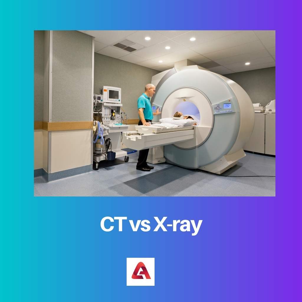 CT مقابل الأشعة السينية