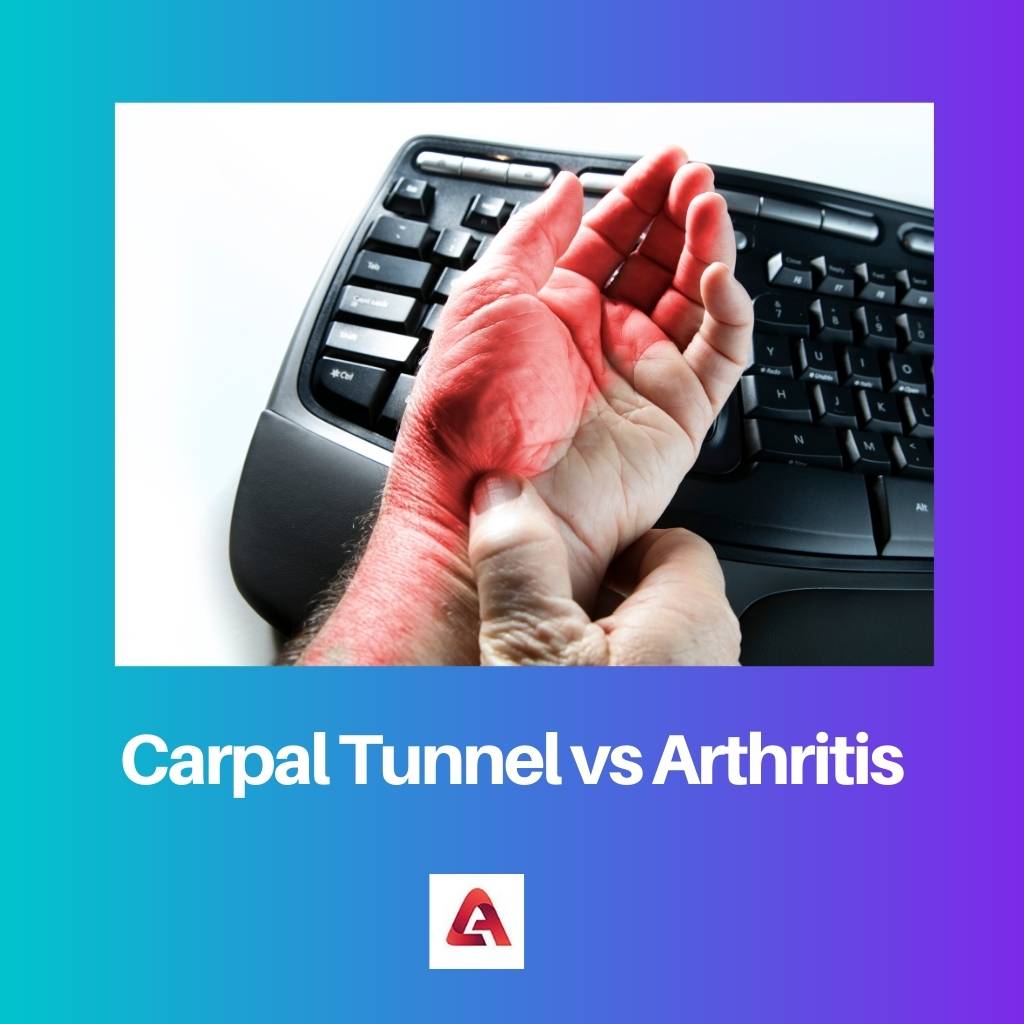 Karpální tunel vs artritida