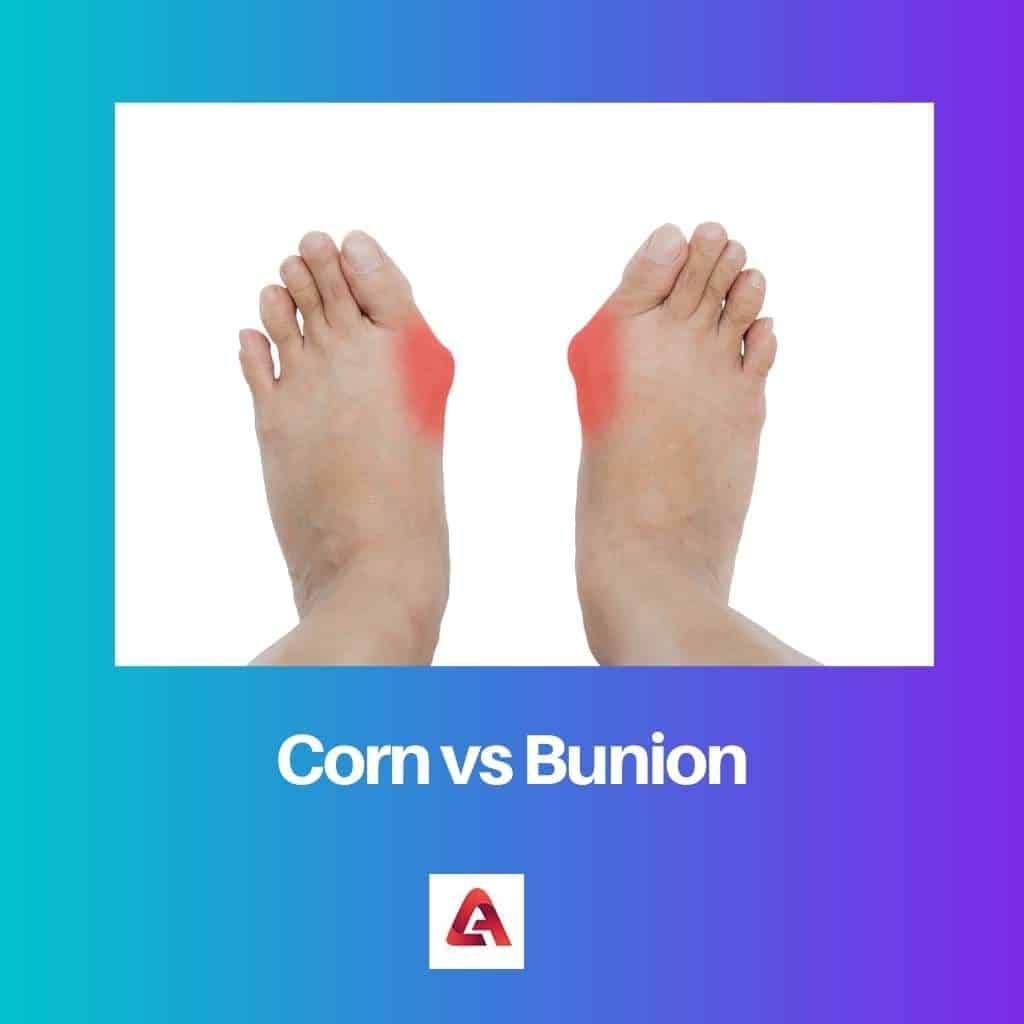 Maïs versus Bunion