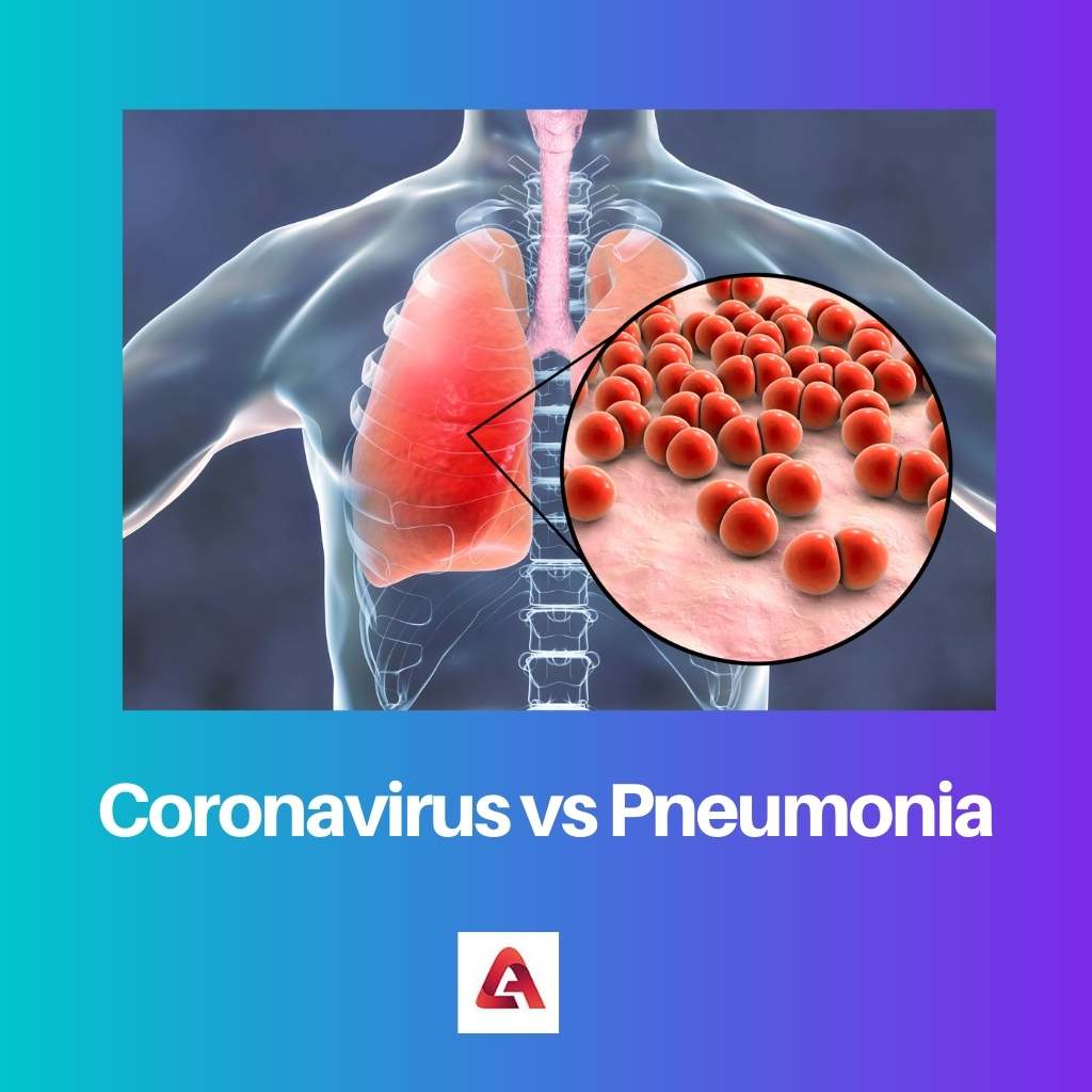 Coronavirus vs Pneumonia
