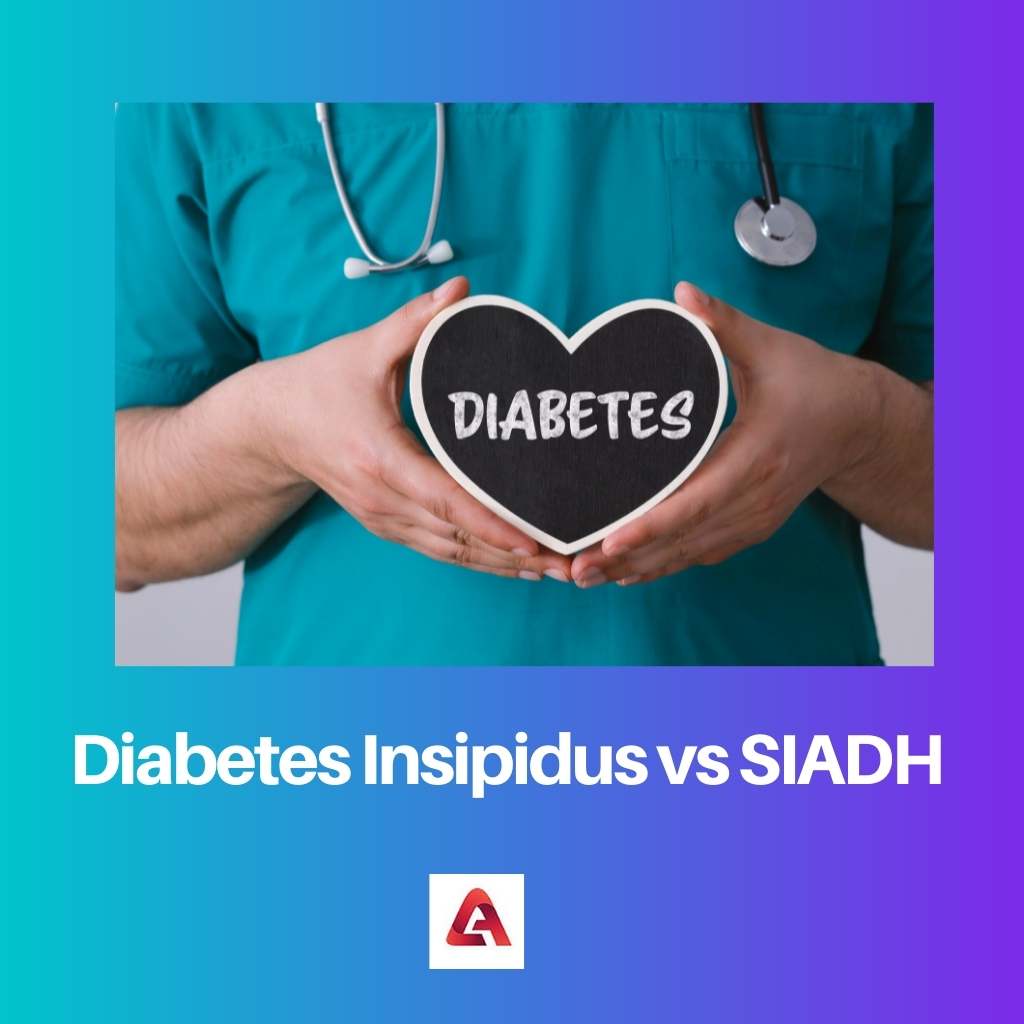 Нецукровий діабет проти SIADH