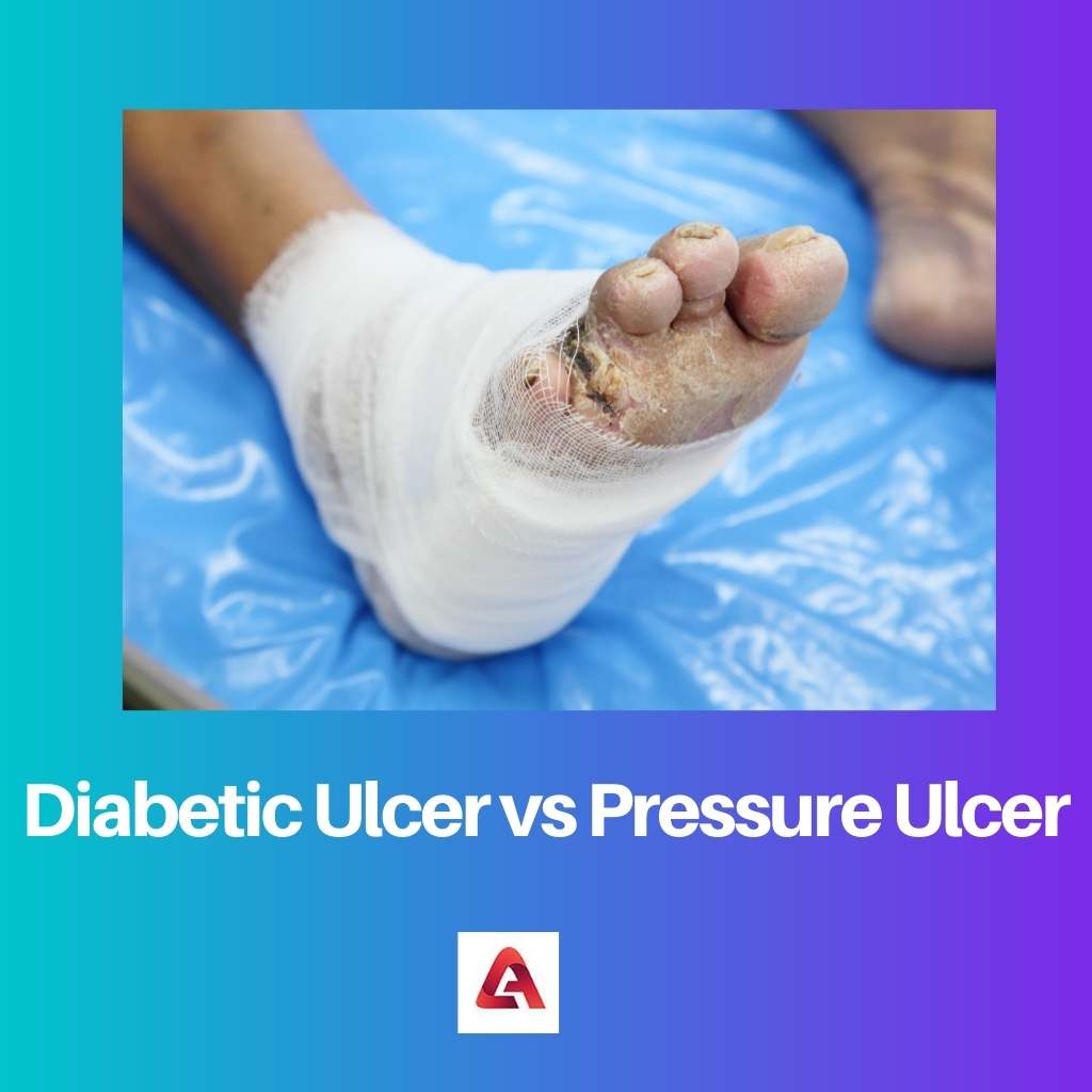 Diabetic Ulcer vs Pressure Ulcer