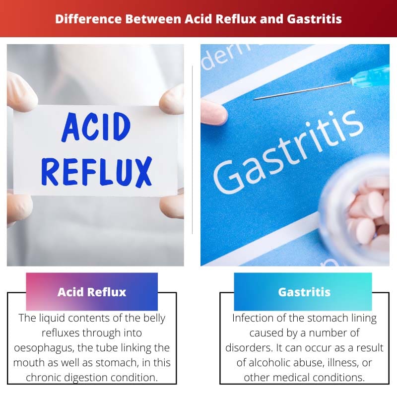 Forskellen mellem sur refluks og gastritis
