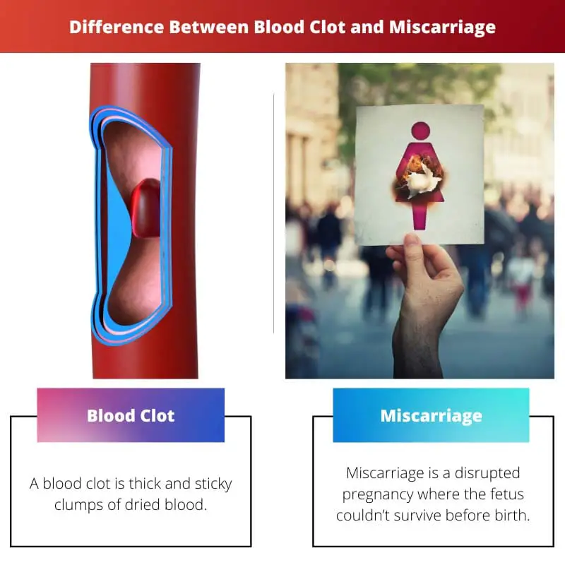 Verschil tussen bloedstolsel en miskraam
