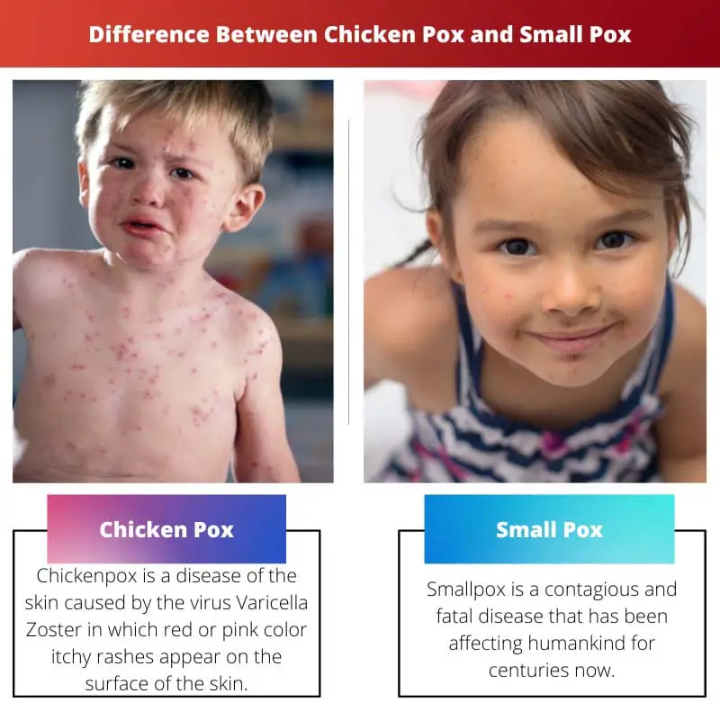 Differenza tra varicella e piccola