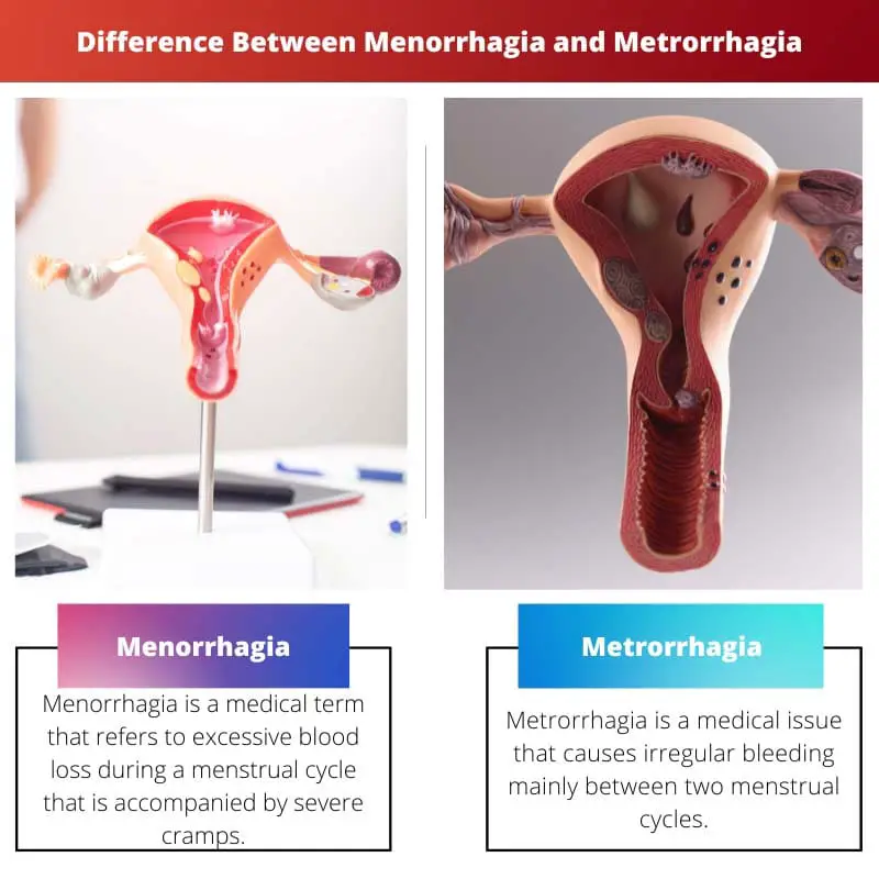 ความแตกต่างระหว่าง Menorrhagia และ Metrorrhagia