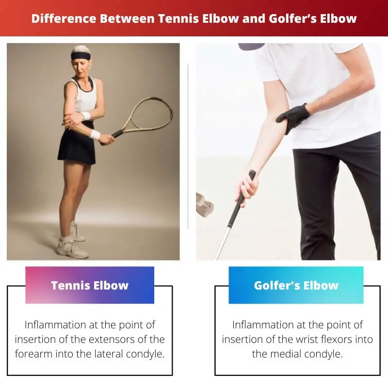 Atšķirība starp tenisa elkoni un golfa spēlētāju elkoni