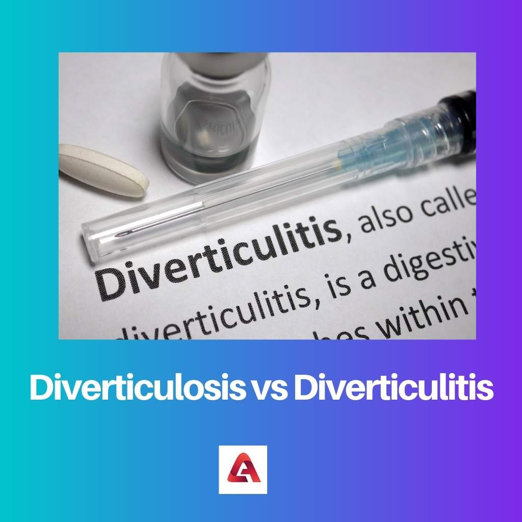 Diverticulosis vs Diverticulitis