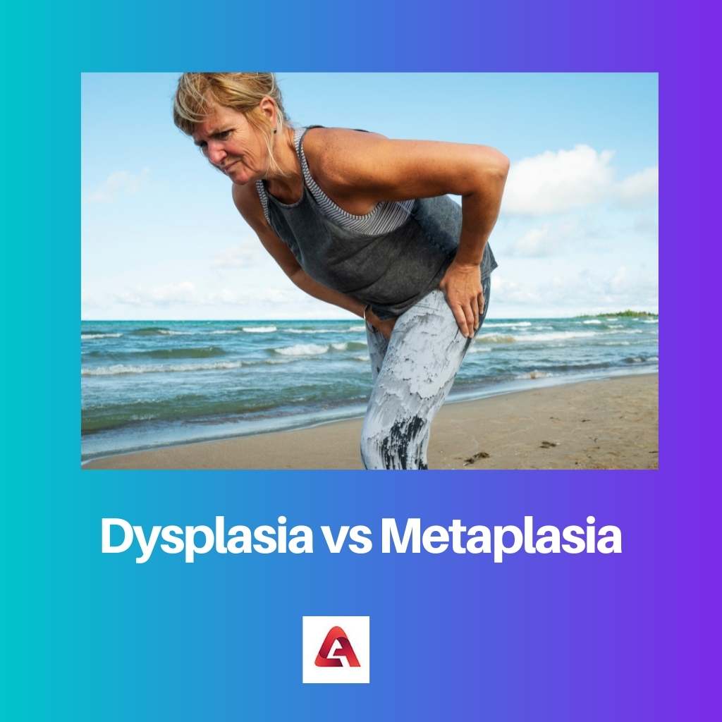 Dysplazie vs Metaplazie