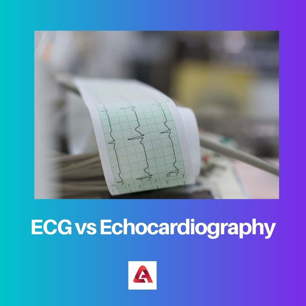ECG vs Echocardiography