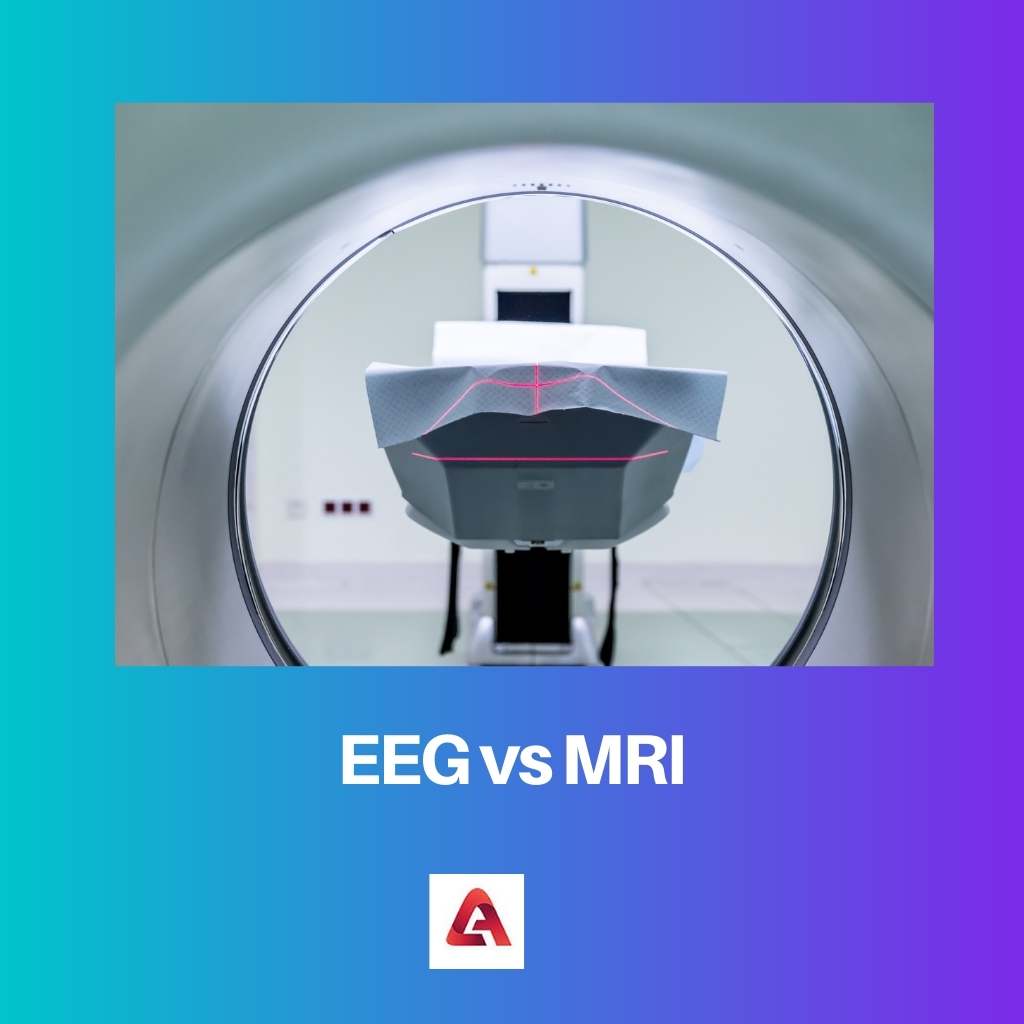 EEG vs IRM