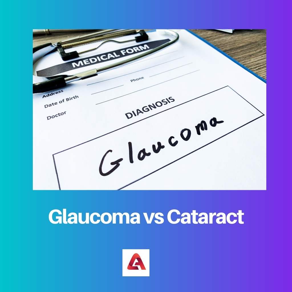 Glaucoma vs Cataract