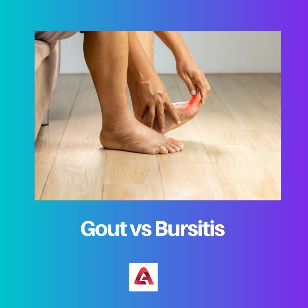 Gout vs Bursitis