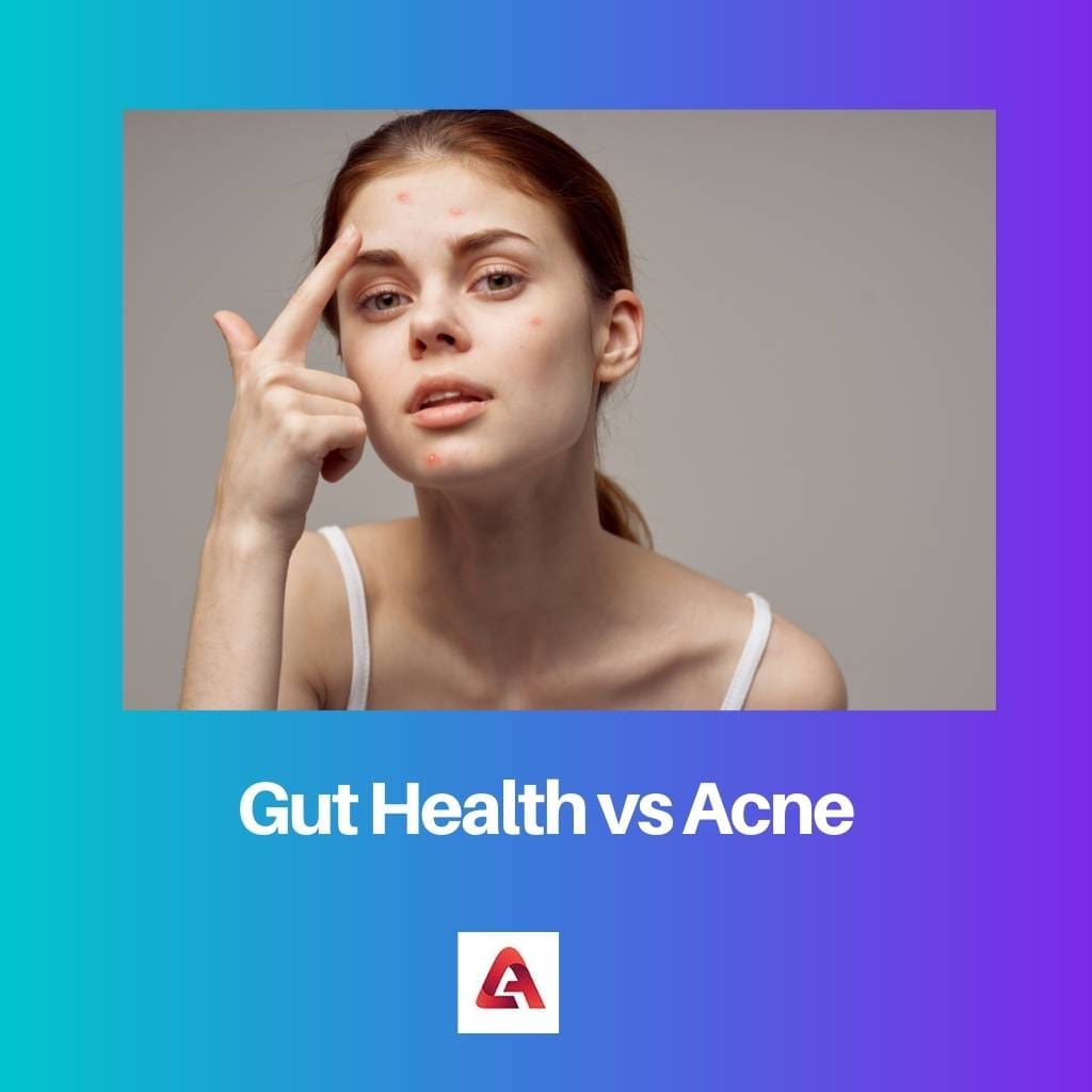 Santé intestinale vs acné