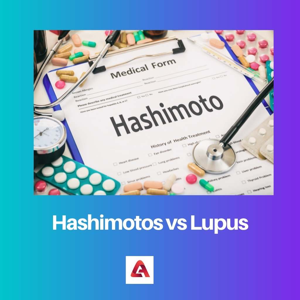 Hashimoto contra el lupus