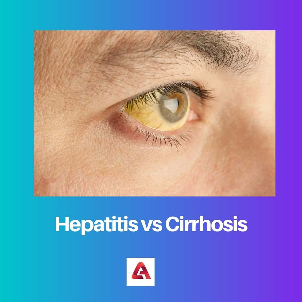 Hepatitis versus cirrose