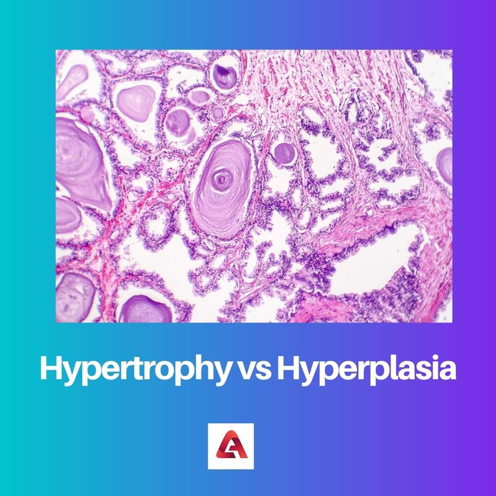 Hypertrophy vs Hyperplasia