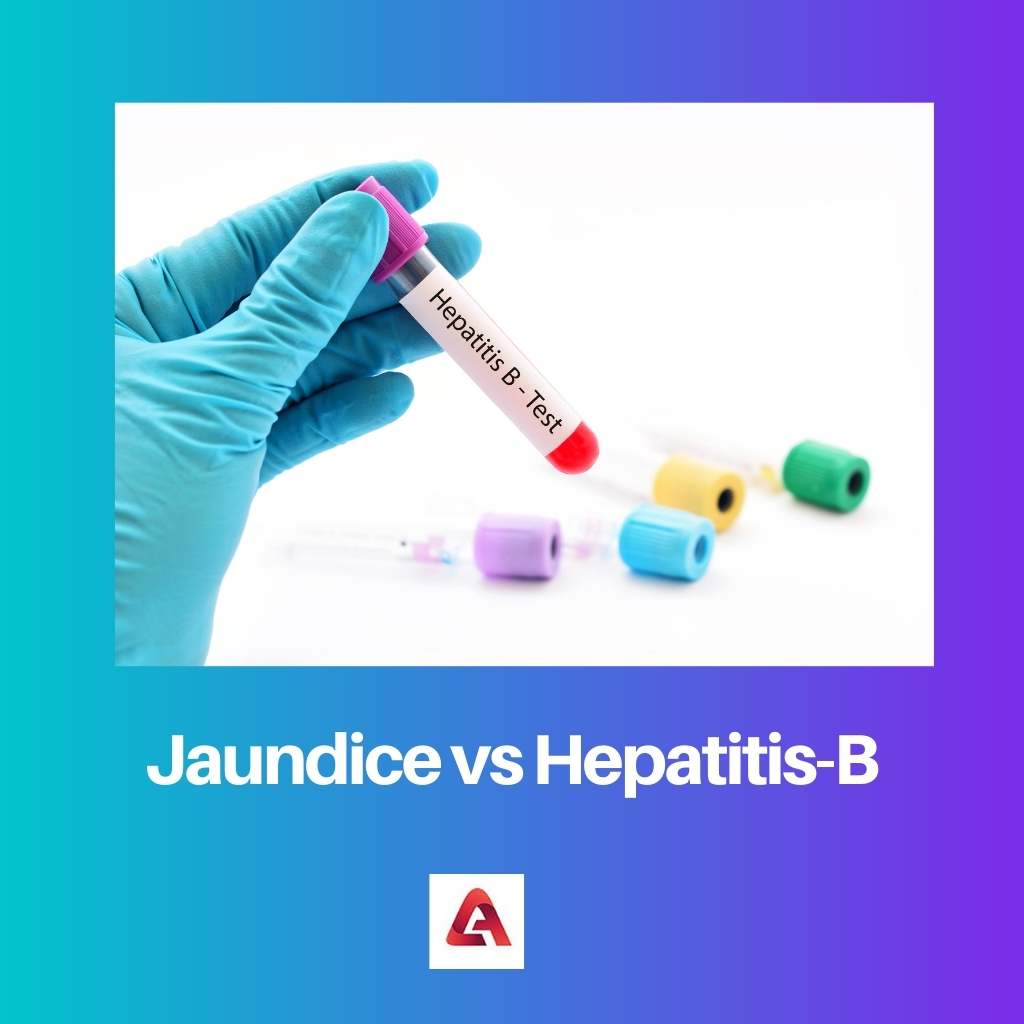 Jaundice vs Hepatitis B