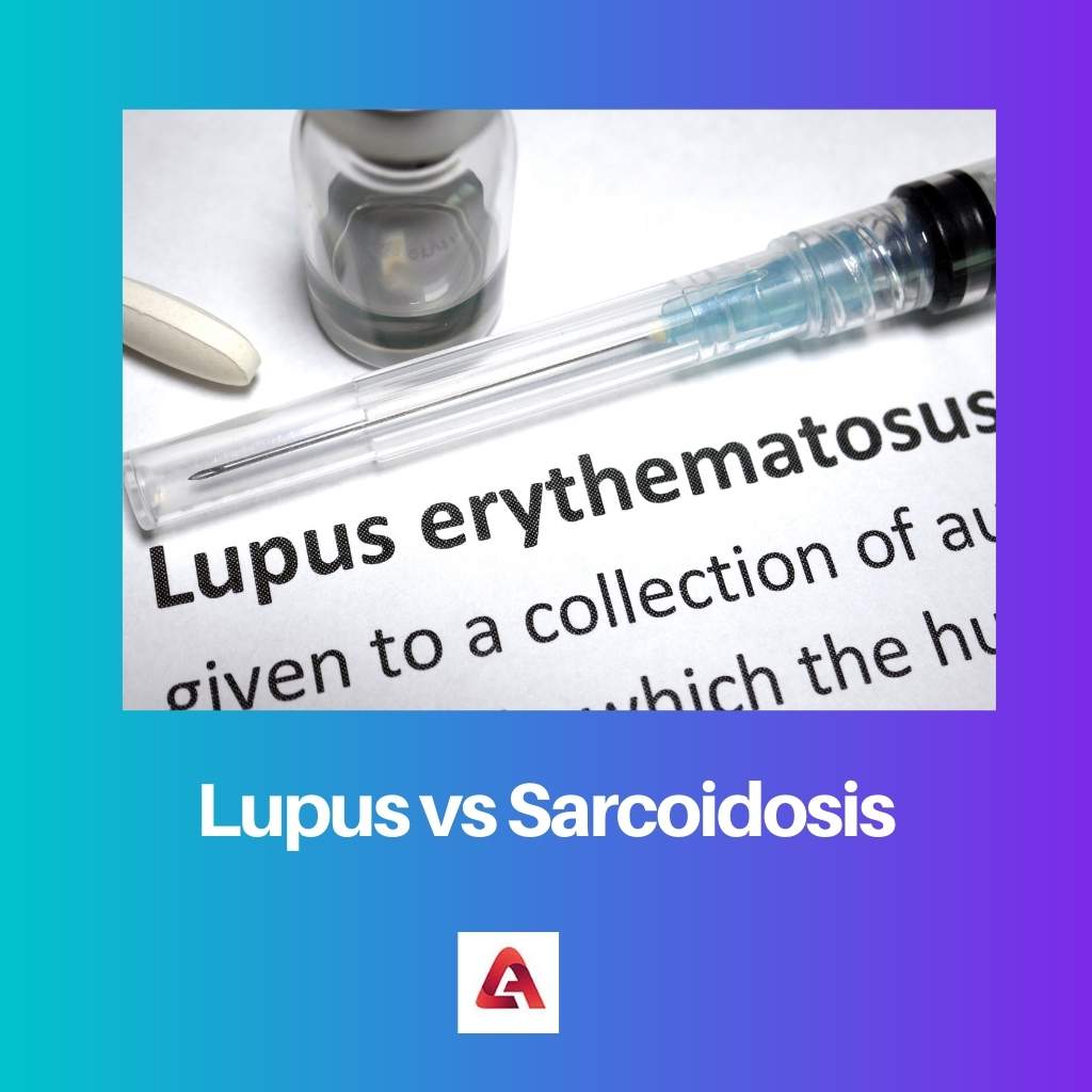 Lupus vs Sarcoidosis