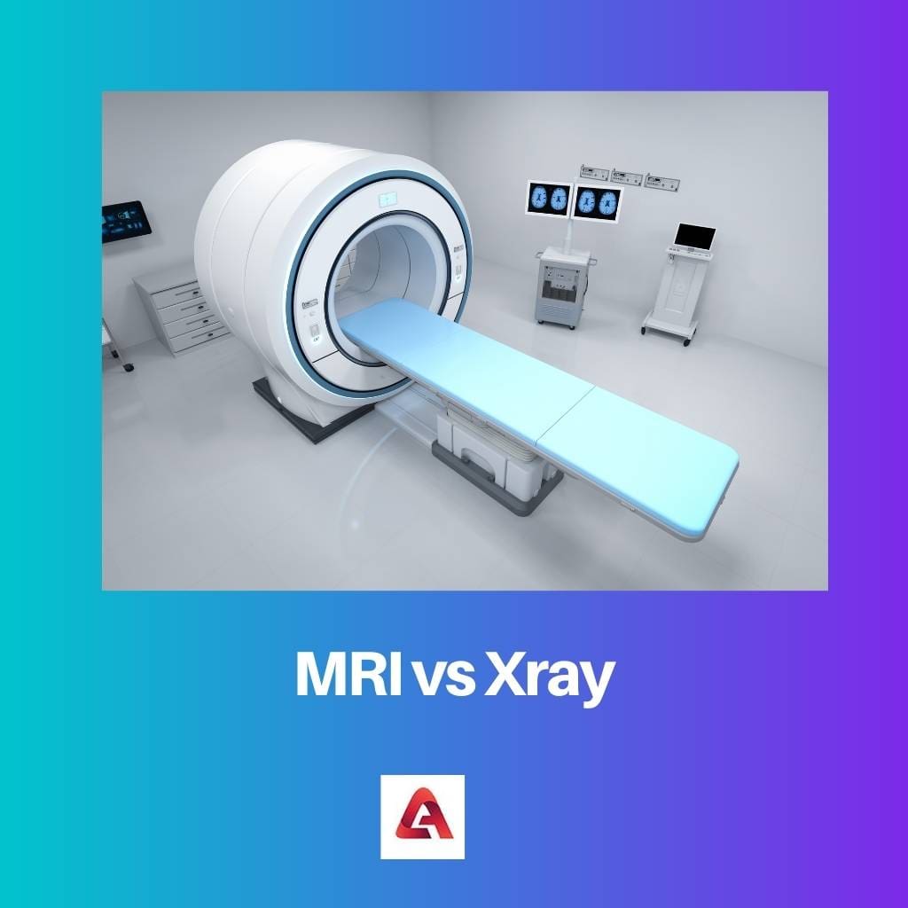 MRT vs. Röntgen