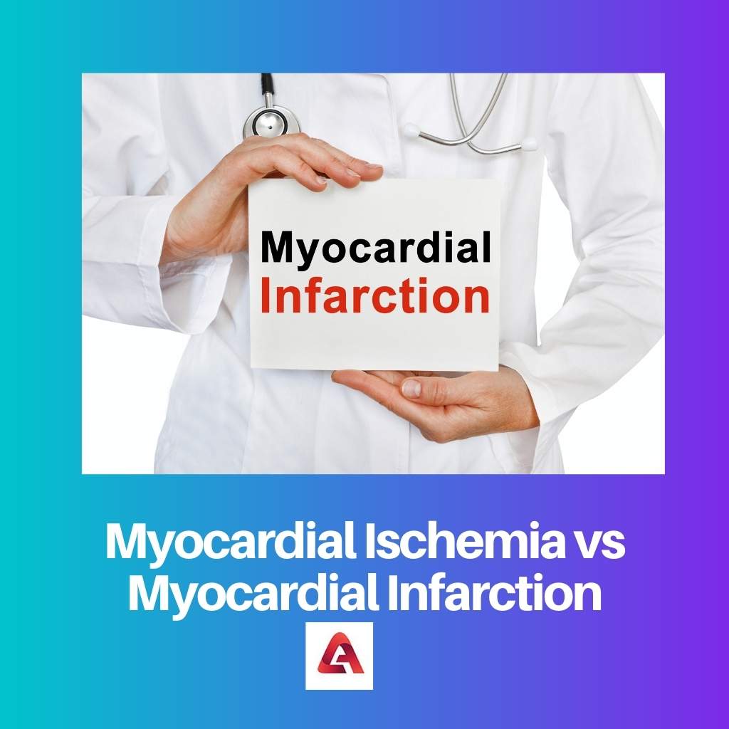 Isquemia miocárdica vs infarto de miocardio