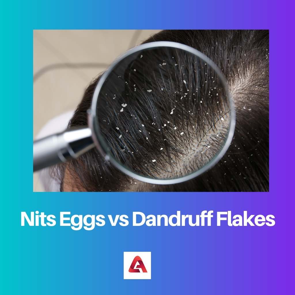 Nits Eggs vs Dandruff Flakes