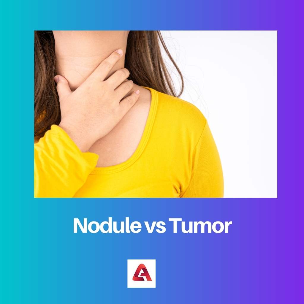 Nodule vs Tumeur